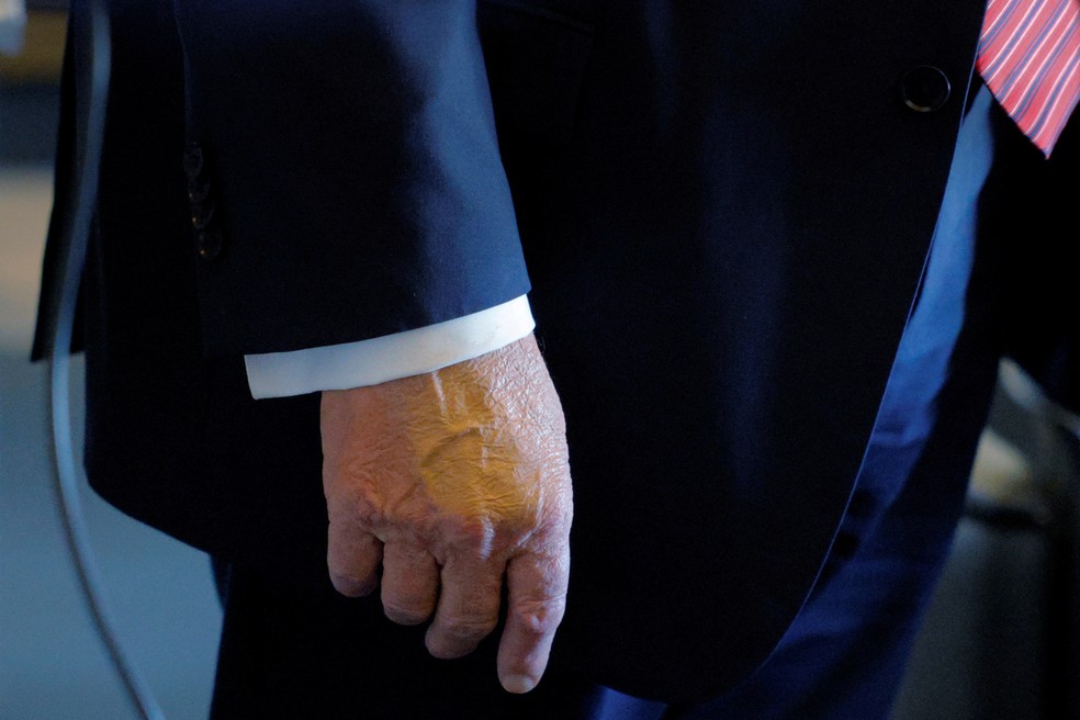 Trump com a mão maquiada em foto do dia 14 de maio — Foto: REUTERS/Brian Snyder