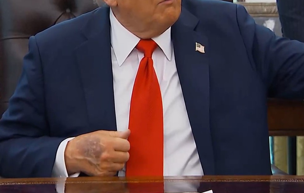 Hematoma na mão de Trump durante evento na Casa Branca em 25 de agosto de 2025 — Foto: Reuters/Reprodução