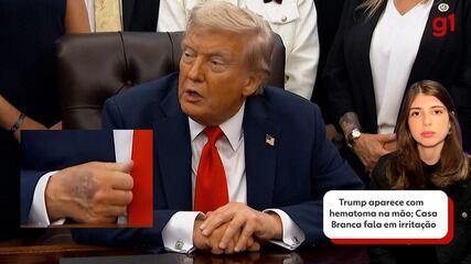 Trump aparece com hematoma na mão; Casa Branca fala em irritação na pele Trump aparece com hematoma na mão; Casa Branca fala em irritação na pele