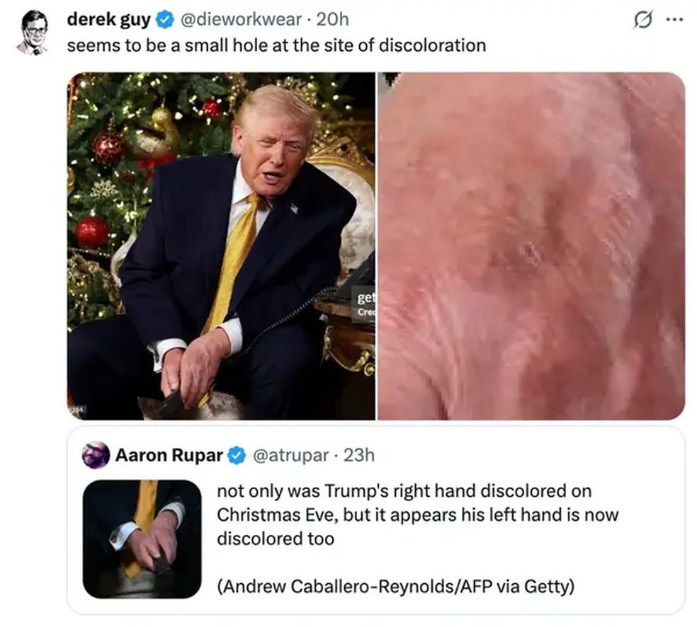 Manchas nas duas mãos de trump repercutem nas redes sociais — Foto: Reprodução / X